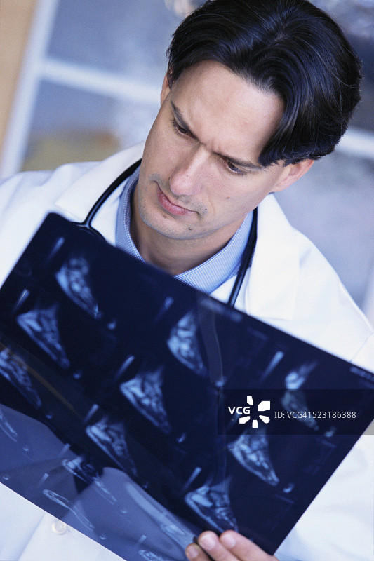 医生检查X光片图片素材