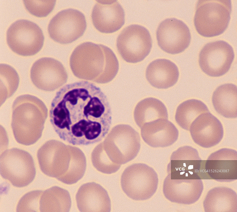 中性粒细胞——白细胞（白细胞），500倍图片素材