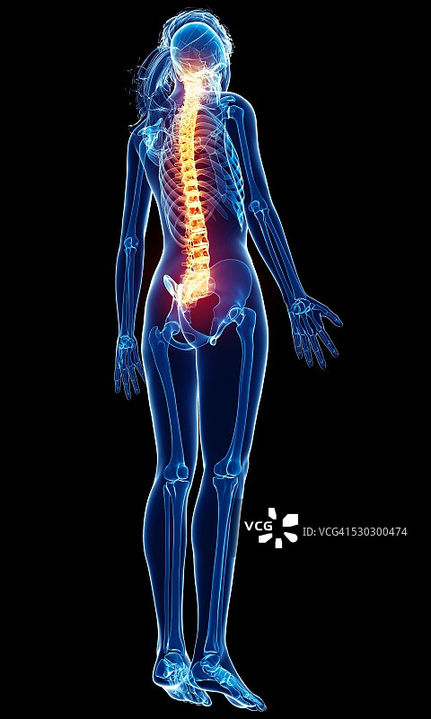 背痛电脑绘图图片素材