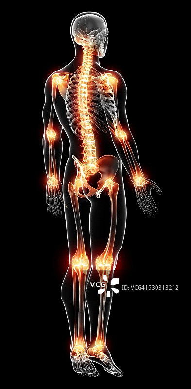 关节疼痛电脑插图图片素材