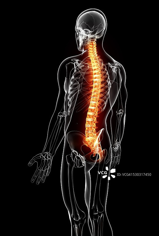 脊柱疼痛电脑艺术作品图片素材