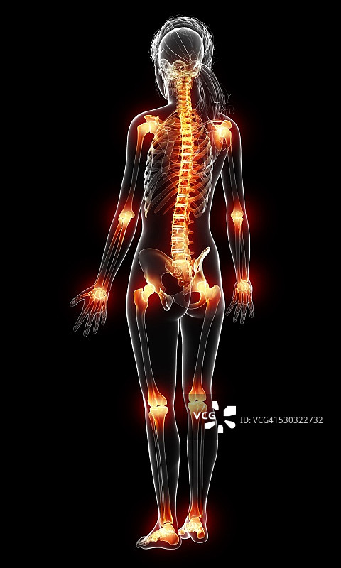 关节疼痛电脑插图图片素材