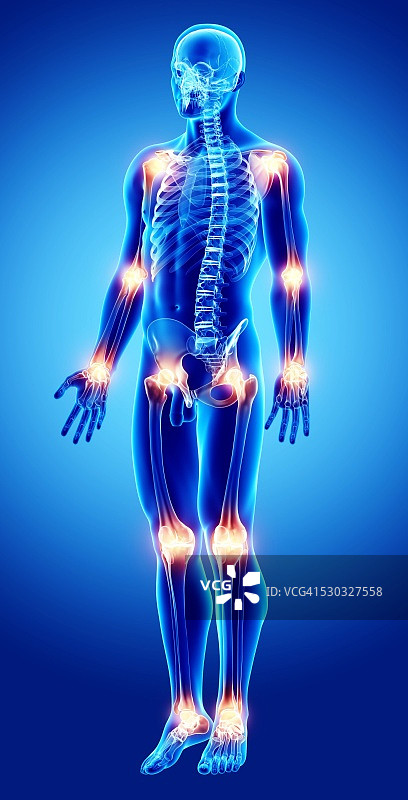 关节疼痛电脑插图图片素材