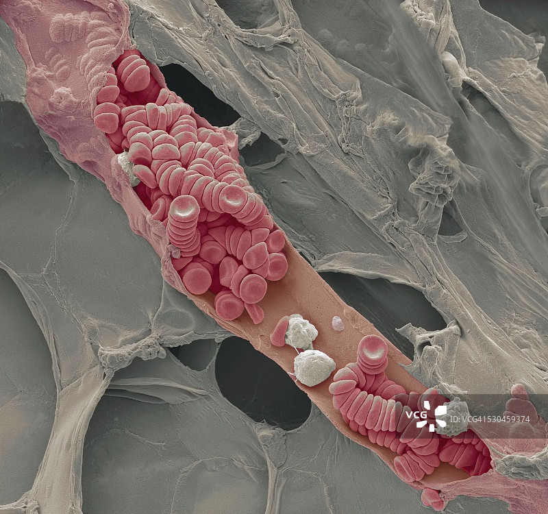 破裂的静脉，扫描电镜图片素材