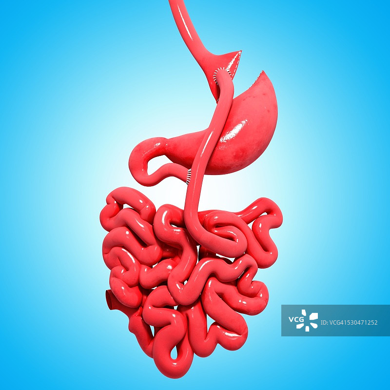胃绕道手术计算机图图片素材