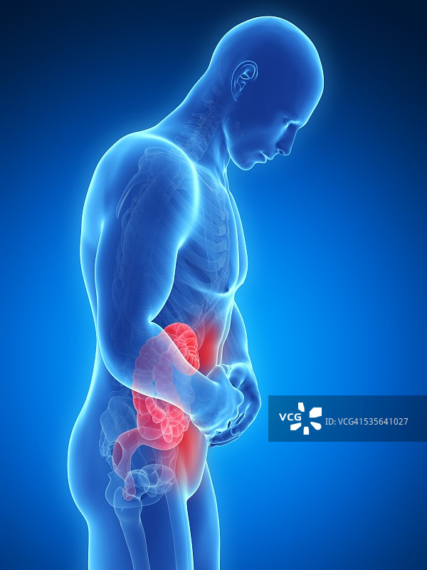 人肠道疼痛插图图片素材