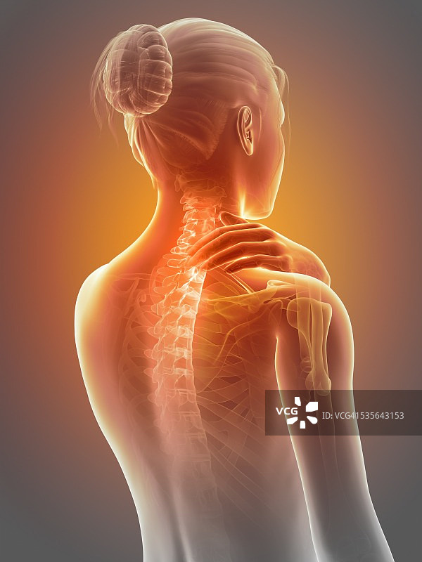 颈椎疼痛插画图片素材
