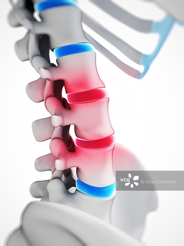 人类椎间盘插图图片素材
