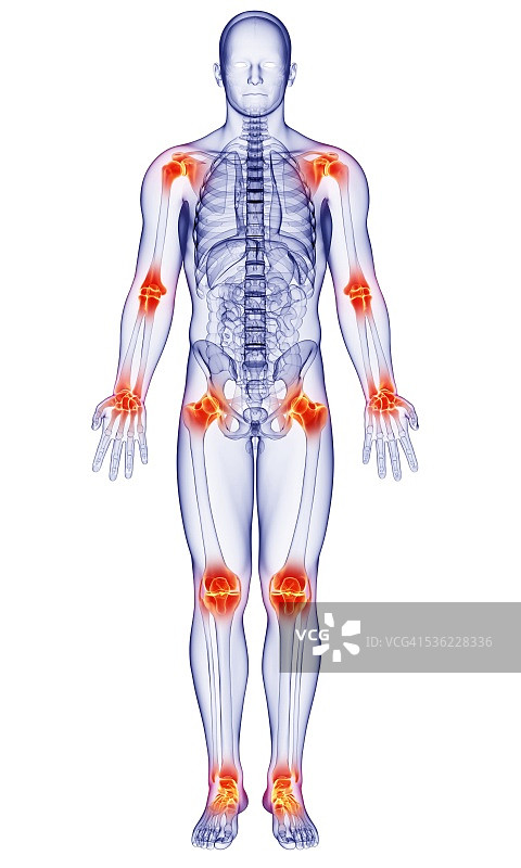 关节疼痛电脑插图图片素材