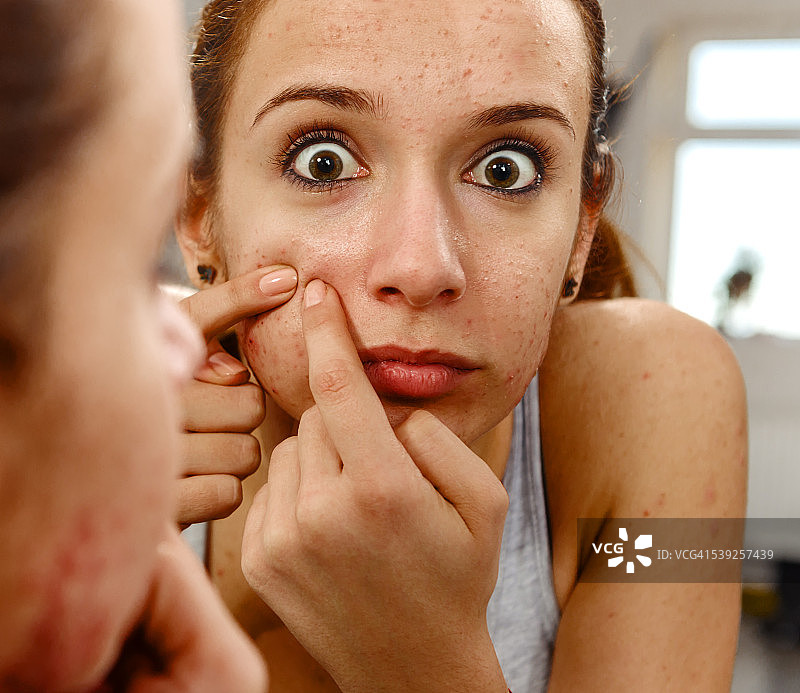 大面积痤疮图片素材