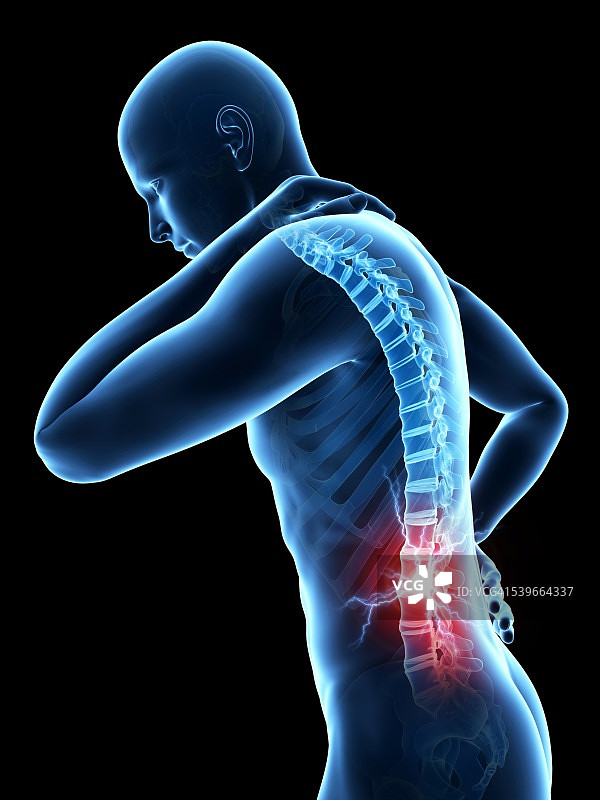 人类背部疼痛插画图片素材