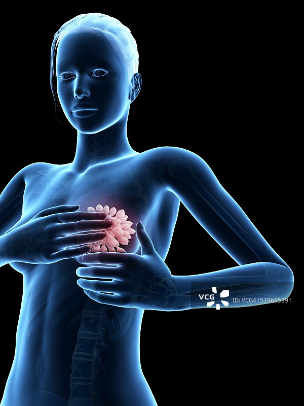 女性乳房检查插画图片素材