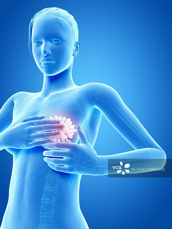 女性乳房检查插画图片素材