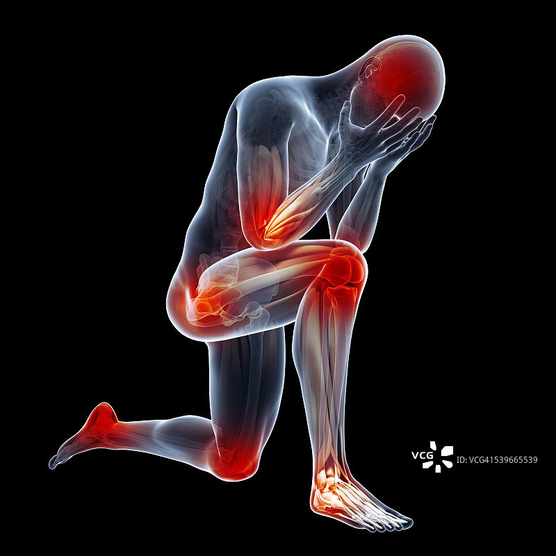 人体关节疼痛图图片素材