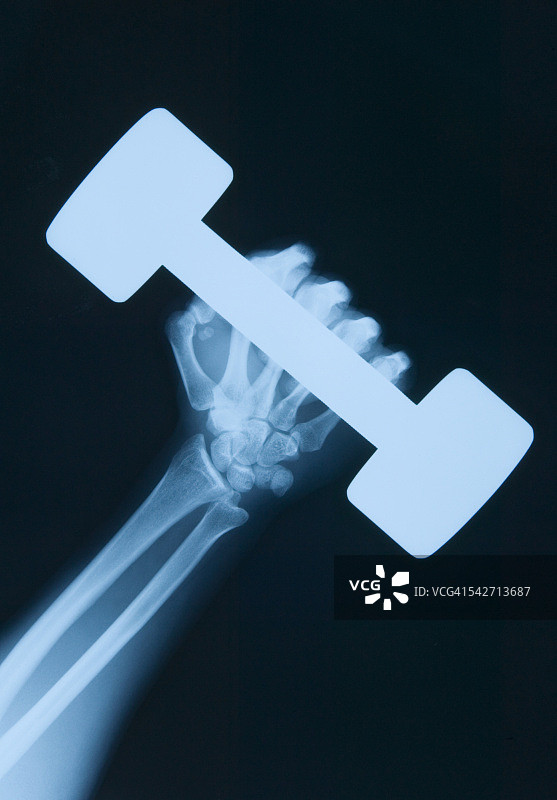 X光图像图片素材