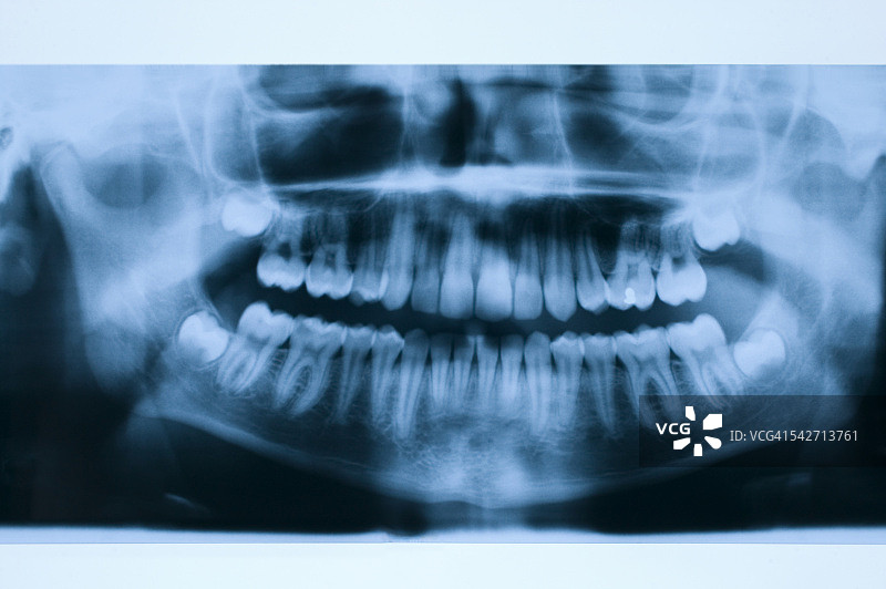 X光图像图片素材