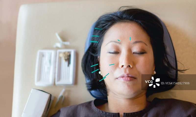 女子接受针灸疗法图片素材