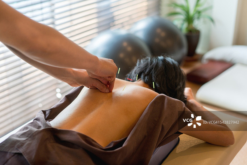 接受针灸的女人图片素材