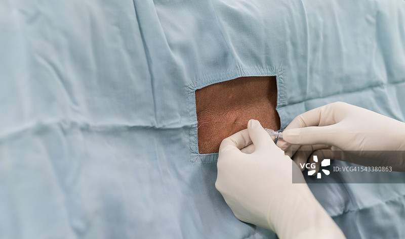 麻醉师进行脊神经阻滞图片素材