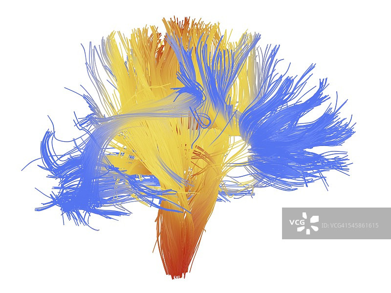人脑的白质纤维图片素材