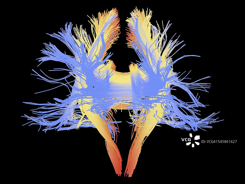 人脑的白质纤维图片素材