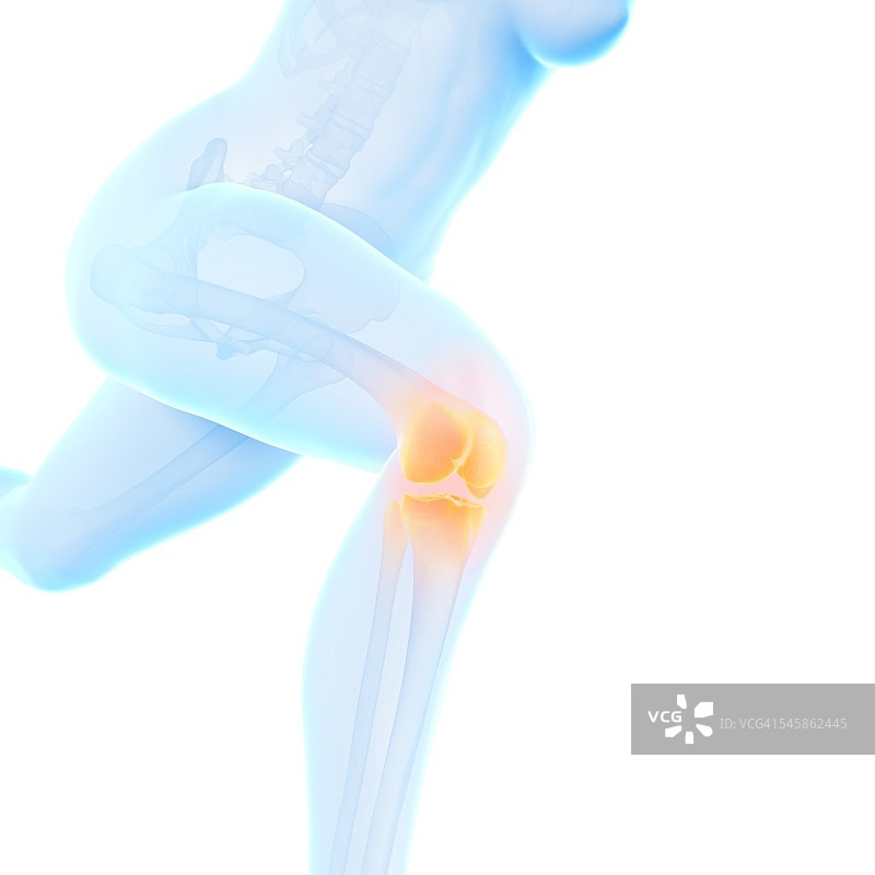 膝盖疼痛的慢跑者插画图片素材