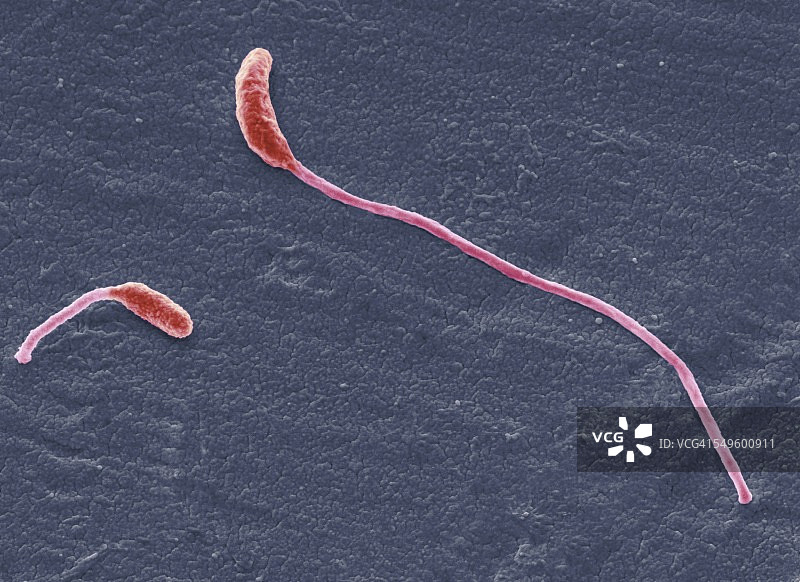 植物发酵梭菌扫描电镜照片图片素材