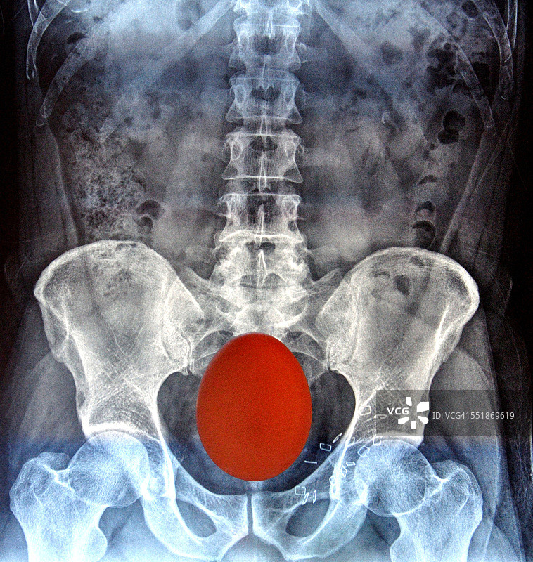 X光摄影。媒介融合图片素材