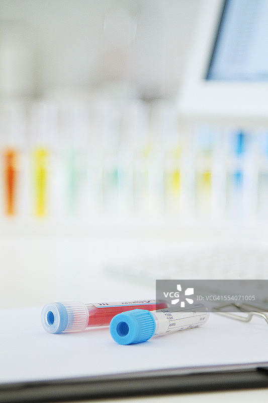 实验室中的血液样本静物图片素材