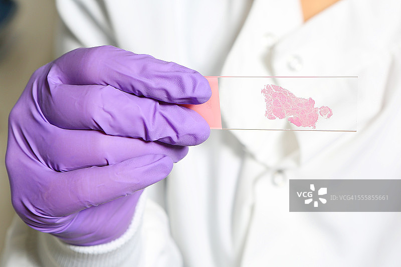 拿着乳腺肿瘤切片的女科学家图片素材