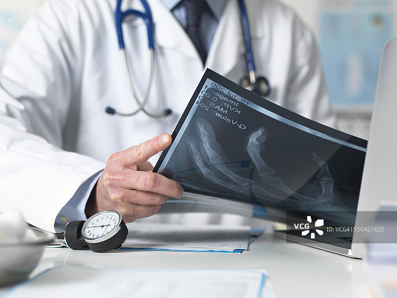 医生在诊所查看手的X光片图片素材