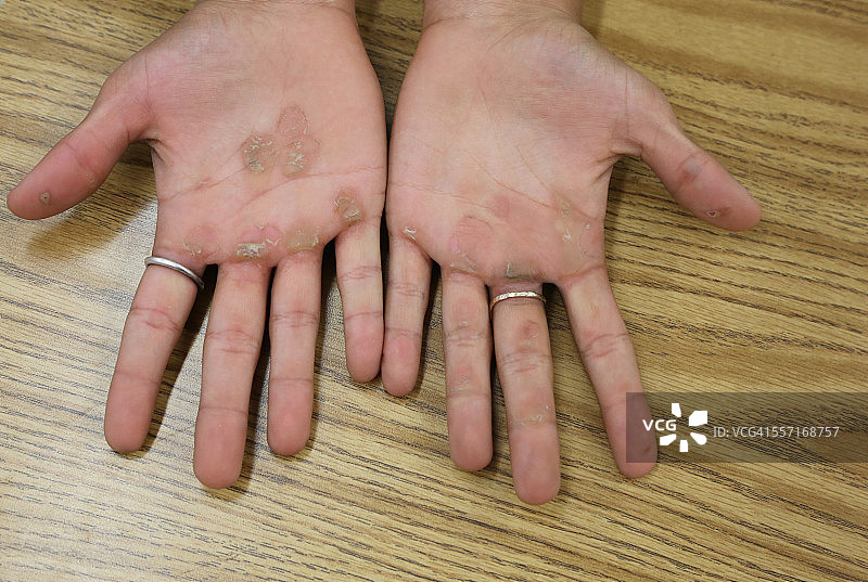 棕榈皱纹图片素材