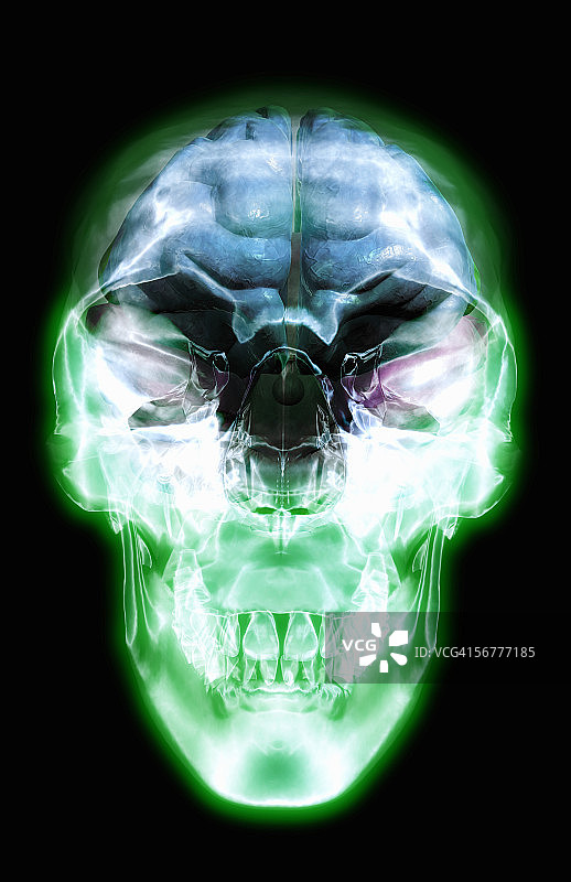 大脑内部解剖结构的X光头骨前视图图片素材