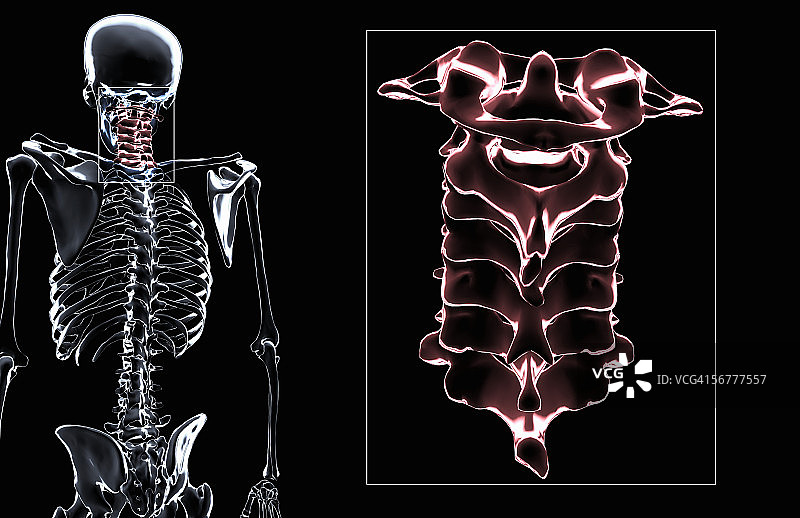 颈椎的前倾风格化视图图片素材