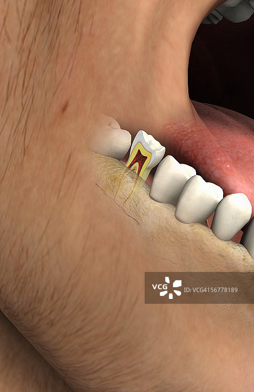 牙齿截面的前视图图片素材