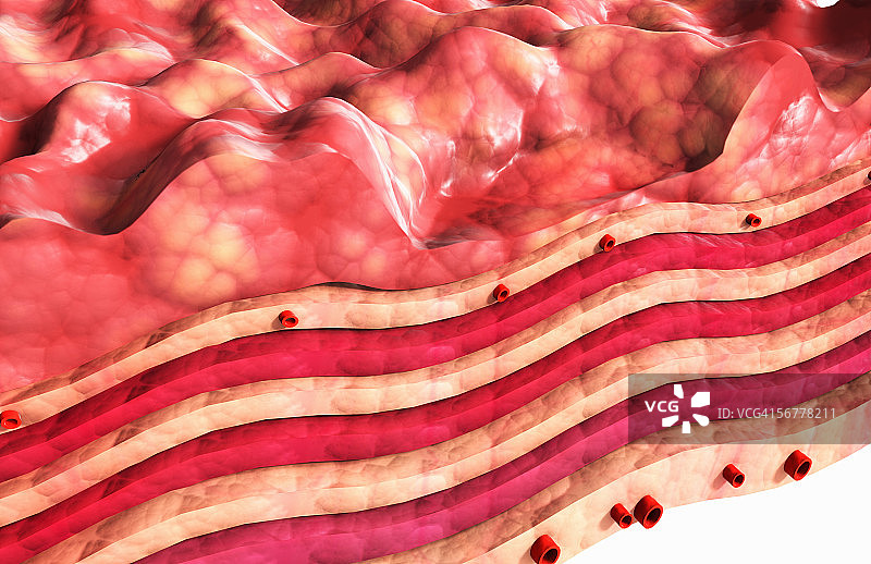 胃壁腐蚀示意图图片素材