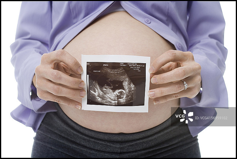 孕妇展示胎儿超声波照片图片素材