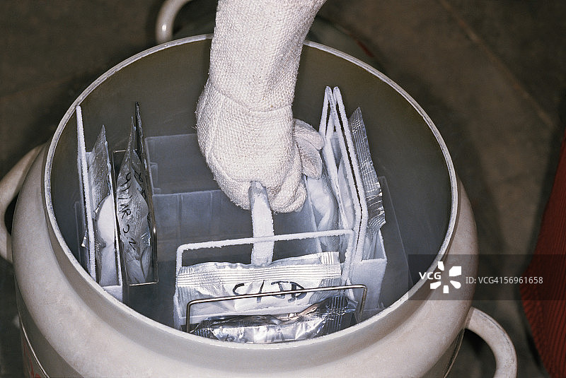 冷冻的供体静脉图片素材