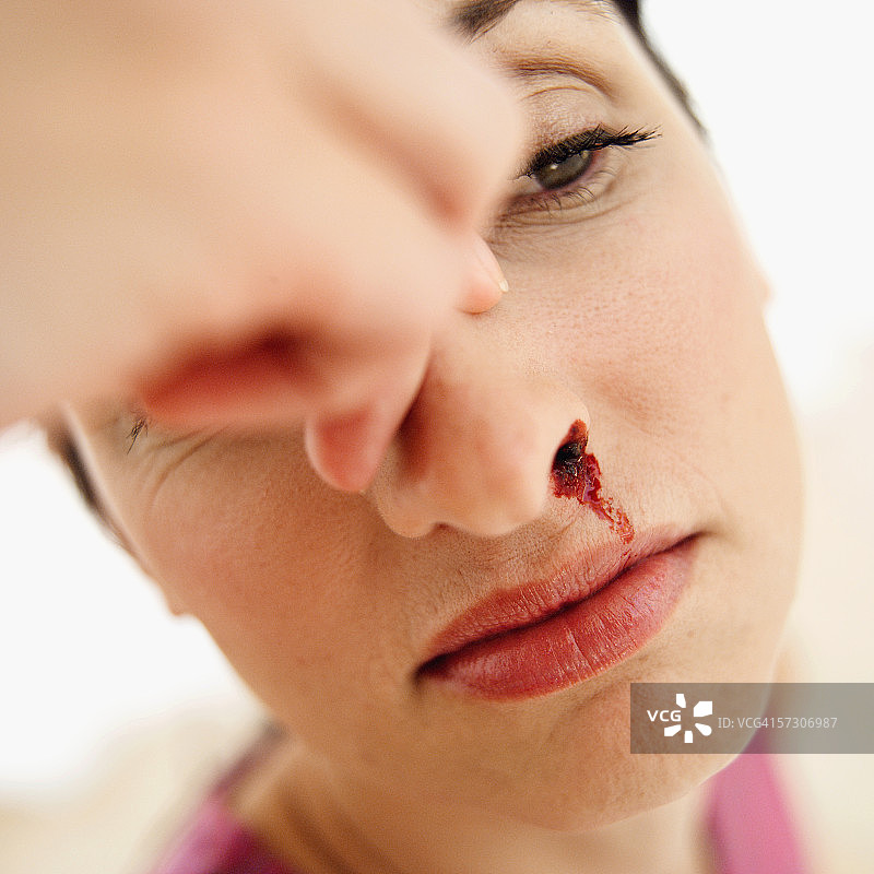 一个流鼻血的年轻女人的特写图片素材