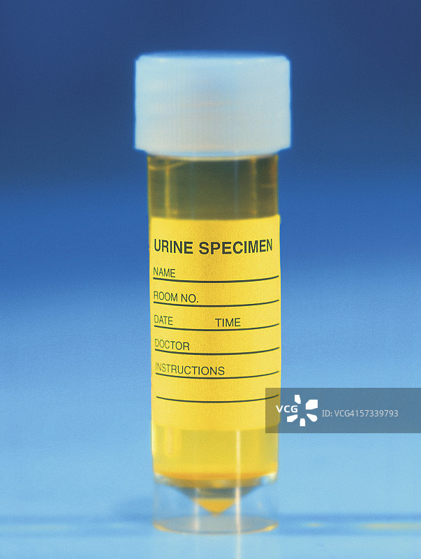 尿液样本瓶特写图片素材