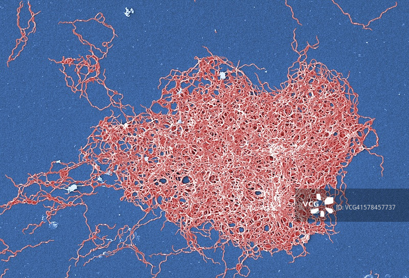 革兰氏阴性厌氧伯氏疏螺旋体细菌的扫描电子显微照片，该细菌来源于纯培养物。这种病原生物是导致莱姆病的原因图片素材