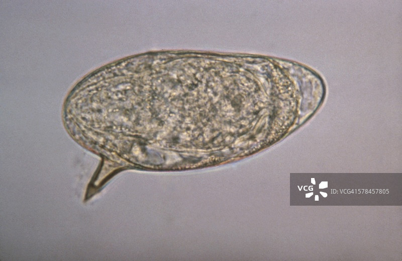 曼氏血吸虫卵显示侧刺，血吸虫病图片素材