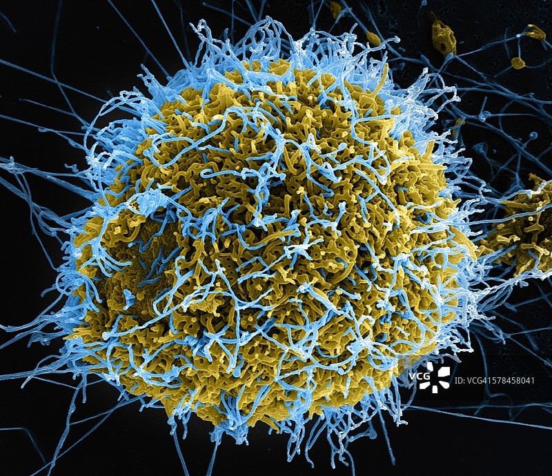 从VERO E6细胞（黄色）中分离出的丝状埃博拉病毒颗粒（蓝色）图片素材