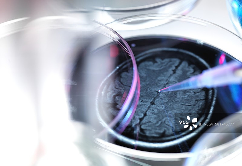 认知障碍研究图片素材