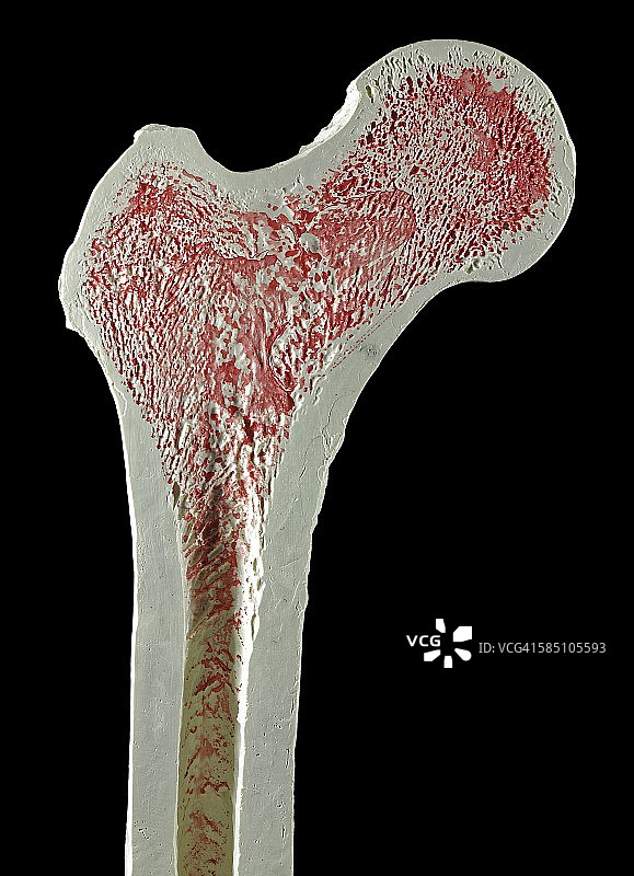 右上股骨图片素材