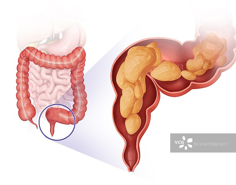 大肠、插图图片素材