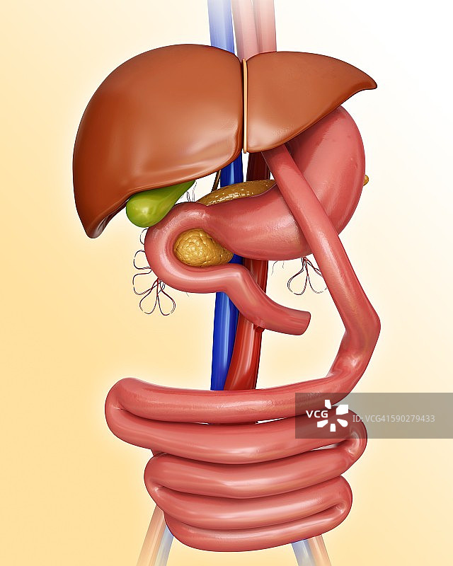胃旁路手术示意图图片素材