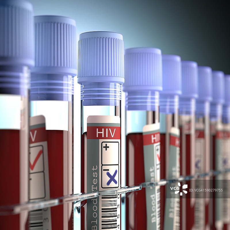 用于艾滋病毒测试的血液样本插图图片素材