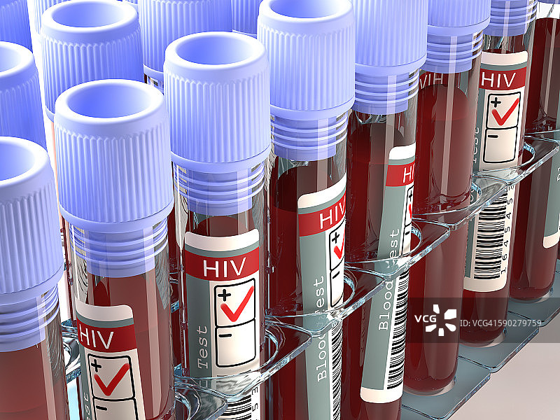 用于艾滋病毒测试的血液样本插图图片素材