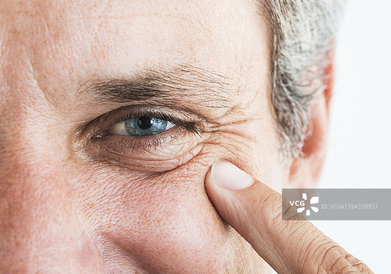 男人指着眼部周围的皱纹图片素材